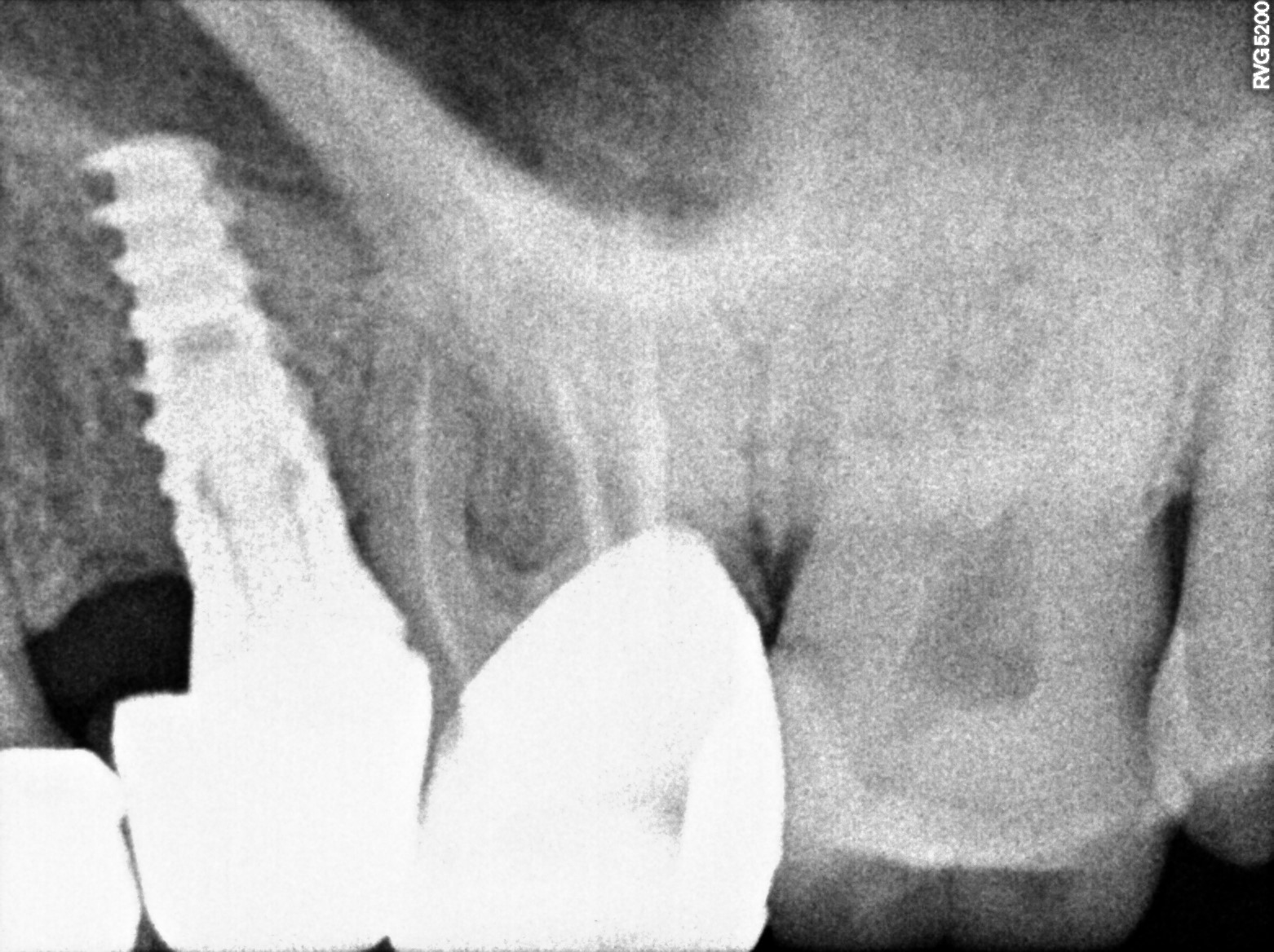 Dental X-ray